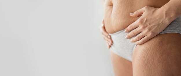 Способы удаления растяжек на теле быстро и безопасно