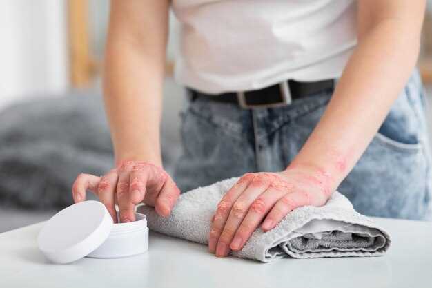 Рецепты настоек из чеснока для борьбы с папилломами